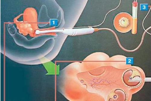 被爸爸宠大的女孩