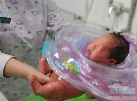 计算胎儿大小的软件