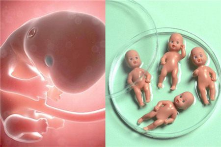 试管婴儿